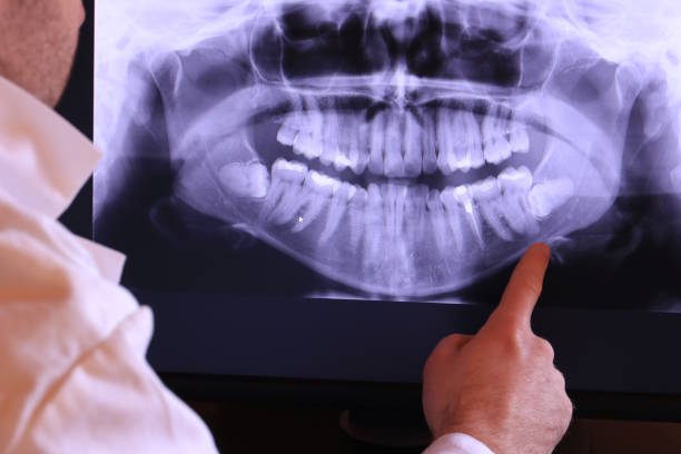 Best Emergency Denture Repair in Carthage, IL