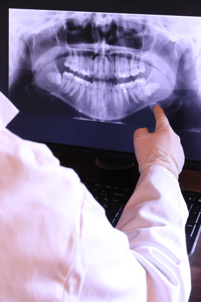 Best Emergency Wisdom Teeth Removal in Carthage, IL